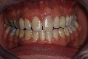 Orthodontics Preston