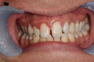 Orthodontics Preston