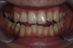 Orthodontics